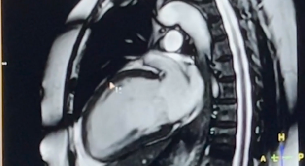 Why is MRI cool? 